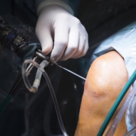Arthroscopy